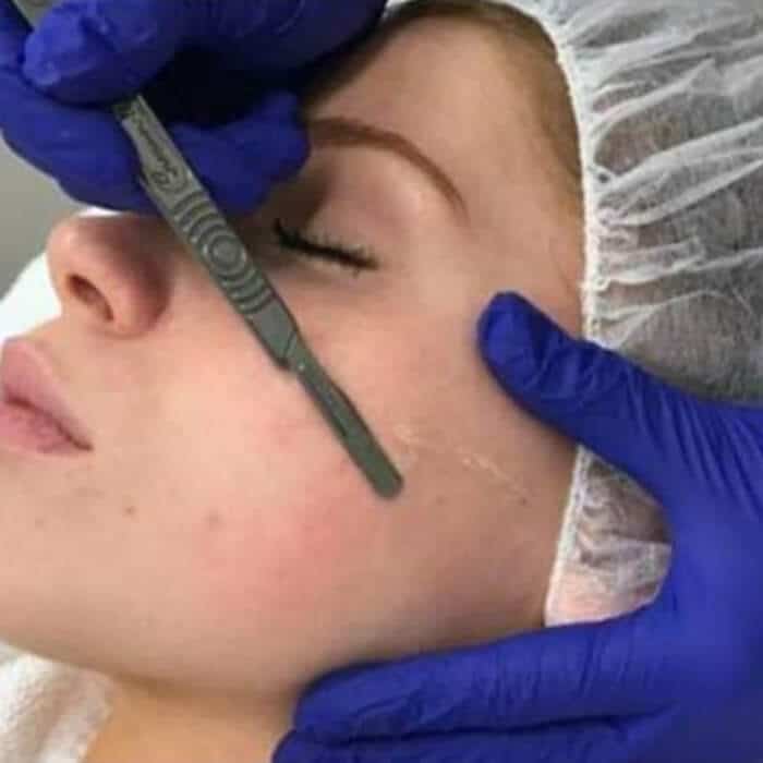 facial-treatment-nearme