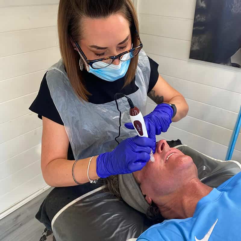 clinicare-midical-micro-needling-gallery-1